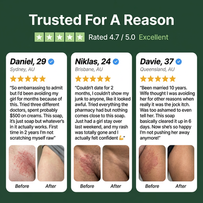 Antifungal Soap